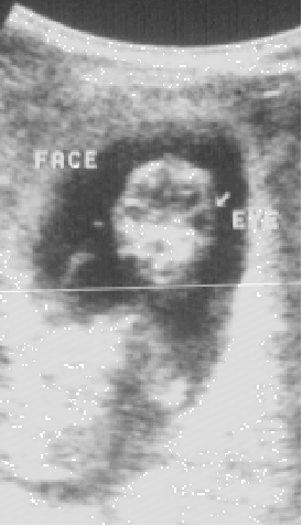 Puppy Ultrasound - Unborn